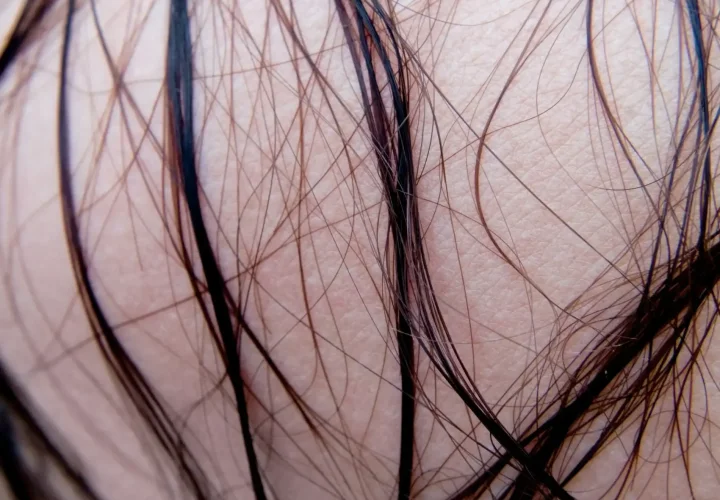 Close-up of individual hair strands showing fine and thicker hairs against the skin